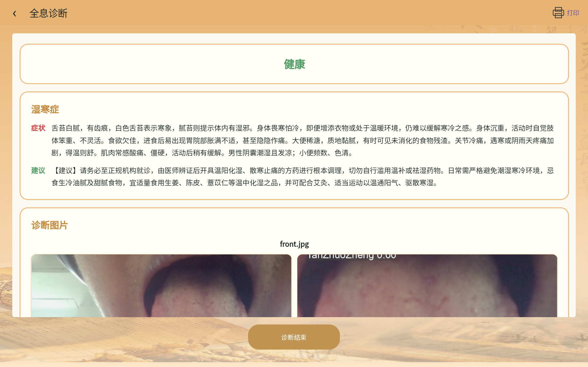 望诊一体机横屏报告